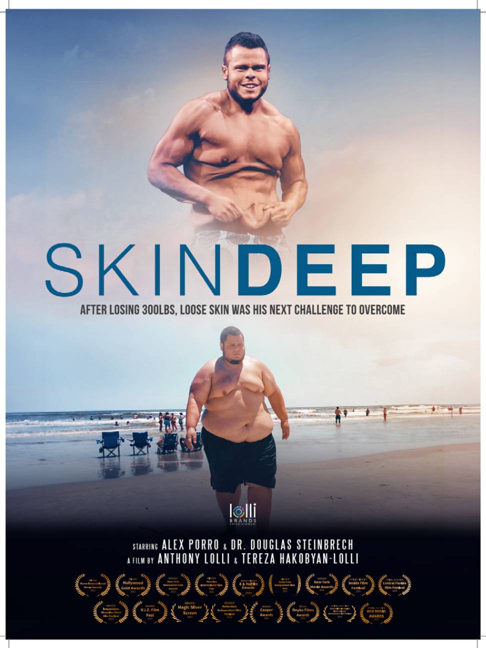 Skin Deep